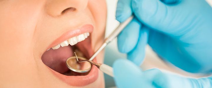 Waarop moet u letten om tandverzekeringen van verschillende aanbieders te vergelijken?