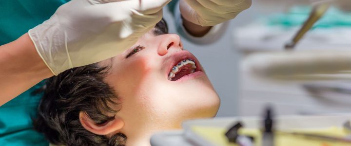 Op jacht naar de beste tandverzekering: goedkoper in de tandartsstoel!